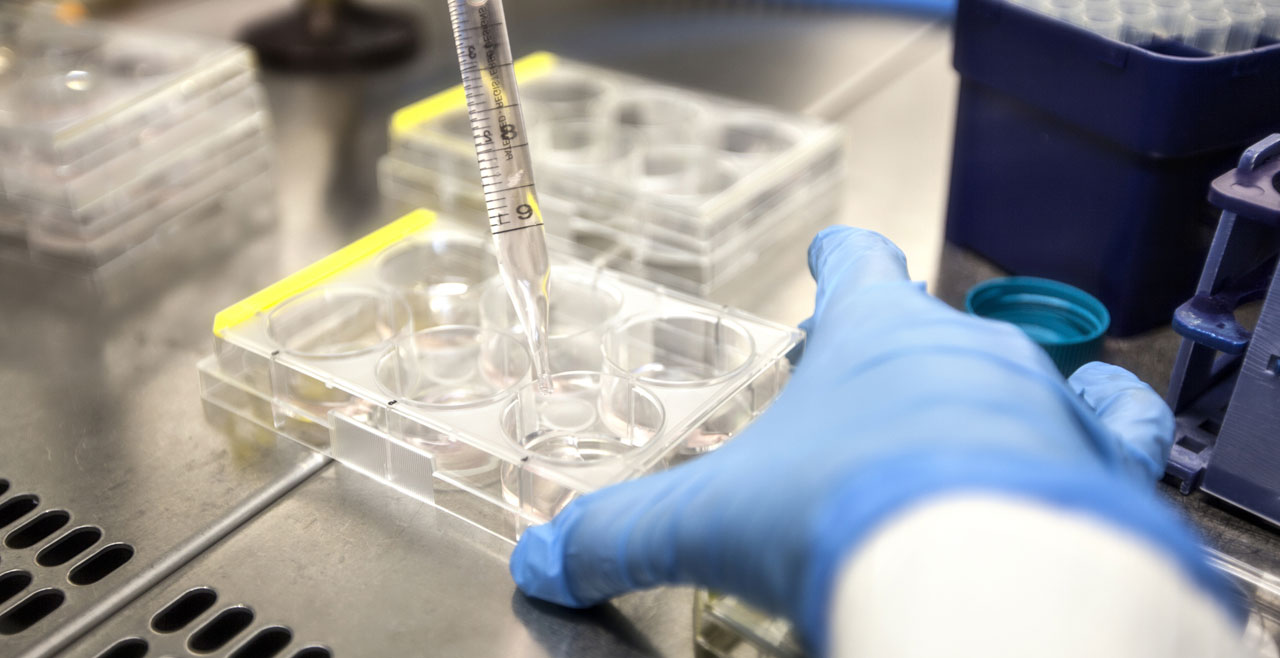 Tüp Bebek Laboratuvarlarında Doğru Sarf Malzeme Seçimi